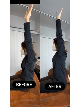 クラーレ(CURARE)/before、after