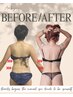 【残3名!!】◆ セル脂肪撃退！別人級痩身体験90分39,800円→