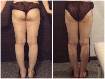 美容整体ウェリナ 名駅院/小顔矯正/骨盤矯正/美脚サロン