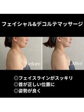 シュ シュ(chou chou)/フェイシャルデコルテマッサージ