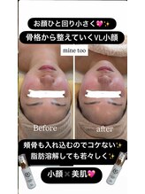 マイントゥー(mine too)/VL小顔★小顔もマッサージ