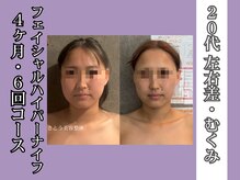 さとう美容整体 町田店の雰囲気(お顔のケアも◎フェイシャルハイパーナイフでお顔もスッキリ!)