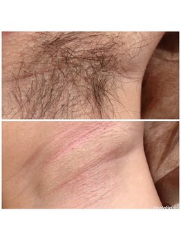 マイレ 銀座(MAILE)/脇