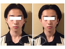 美極 銀座店/銀座/小顔コルギ/小顔矯正