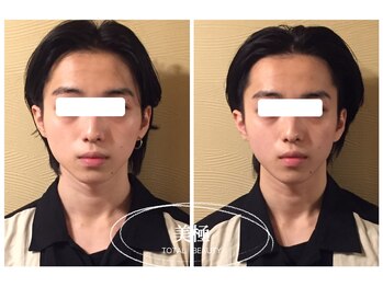 美極 銀座店/銀座/小顔コルギ/小顔矯正