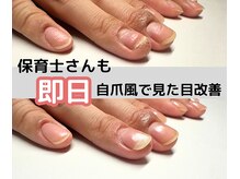 クウ(KUU)/自爪風ネイルで深爪矯正