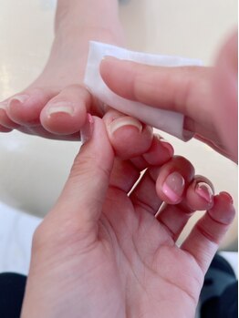 ウェルズユキ(well's yuki)の写真/ガサガサかかとは卒業！固くなった角質を徹底除去してツルツルの足裏に♪タコ・ウオノメが痛い方にも◎