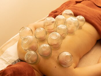 ユミ ボディーバランス(U MIボディーバランス)/カッピング