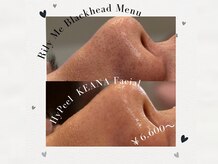 リリーミー(Rily Me)