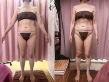 美容整体カラダリメイク(karada)/骨盤矯正ダイエットの結果