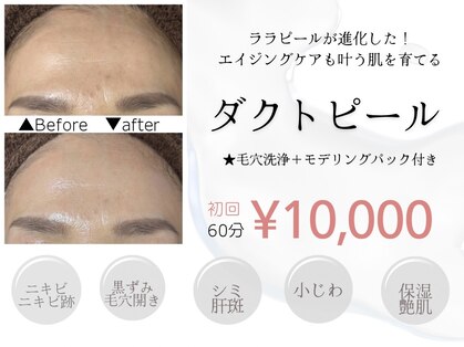 ソレラ(sorelle)の写真