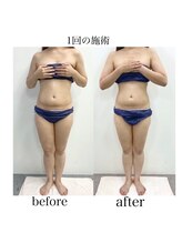 ムム(MooMoo)/お腹周り美くびれ