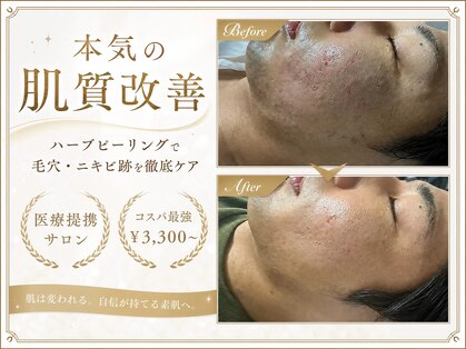 ルビー 西新宿店(Ruby)の写真