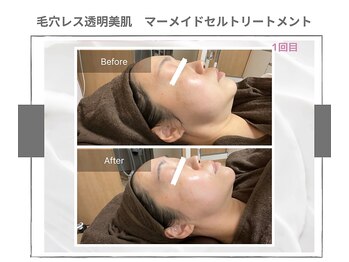 ラ ルーチェ 星田/マーメイドセルトリートメント