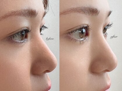 シューナランド(schoner Rand)の写真