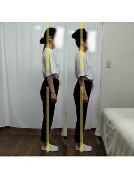 サンイチゼロ(310)/before→after