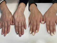 ネイルズニコ(Nails nico)