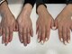 ネイルズニコ(Nails nico)の写真/エリア希少☆《手の専門サロン》「奇跡のハンドトリートメント」の取り扱い有り!!健康的な美しい手へ◎