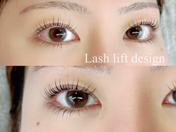 ユーロ(EURO)/上下のラッシュリフト