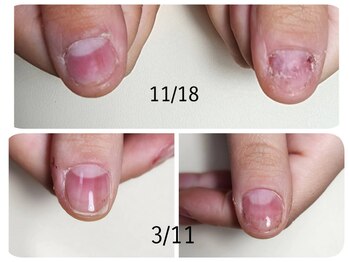 トミーズネイル(tommy's nail)