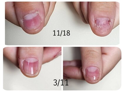 トミーズネイル(tommy's nail)の写真