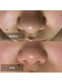 チョアチョア 札幌すすきの店(CHOA-CHOA)/