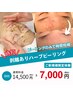 速攻実感！繰り返しニキビに◎時短ハーブピーリング・ダウンタイムあり￥7000
