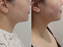 スキンスタジオ レア(Lea)/