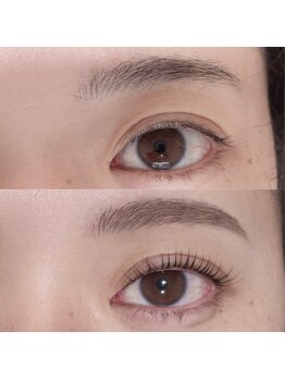 トレス(tres)/同時施術で美人度アップ