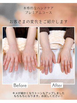 ルポの写真/もちもち肌へ導くパラフィンパックとハンドケアで、心満たされるリラクゼーションを★