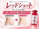 ディアーム 光明池店(Diarm)の写真/レッドショットポッコリお腹をケアして、脂肪分解美容液でハミ肉にアプローチ！理想のくびれを目指そう♪