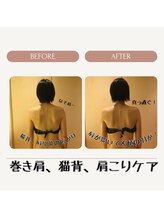 テクニカルエステ インカント(INCANTO)/巻き肩ケア