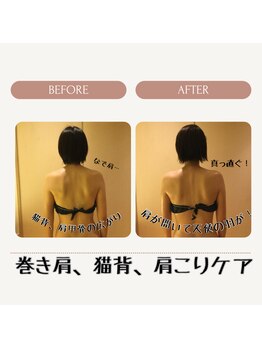 テクニカルエステ インカント(INCANTO)/巻き肩ケア