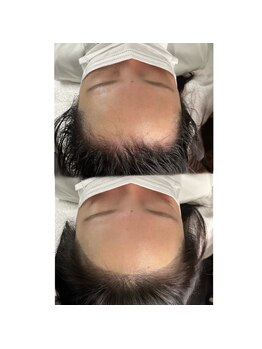 エクスクラメーションマーク(!!!)/ヘアラインアート