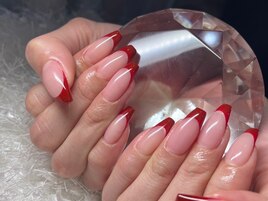 フレンチ☆フィルイン☆オフケア