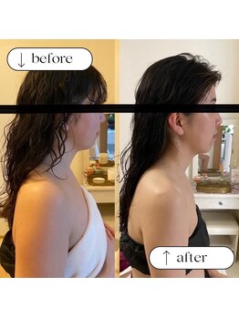 トータルビューティーサロンリア(Li'a)/ビフォー＆アフター