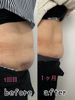 レアレア(Lea l'ea)/1回でこの結果