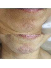 シャイニー(SHINY)/50代女性