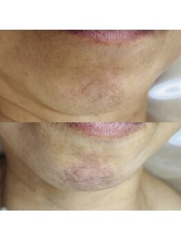 シャイニー(SHINY)/50代女性