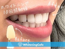 ホワイトニングカフェ 仙台店の雰囲気（黄ばんだ歯はイメージダウン↓白い歯で好印象＆清潔感up☆）