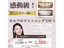 ホワイトニングショップ 山科店