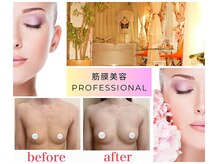 ブロッサム 山内店