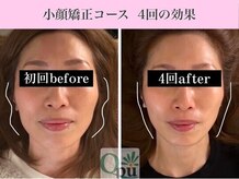 小顔美容矯正専門サロンQpu 福岡大牟田店【キュープ】