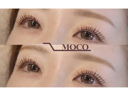 モコ(MOCO)の写真