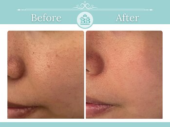 ゼロ美人 那覇店(ZERO美人)/【シミケア☆シミケアZERO美人】