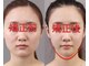 東陽整体 溝の口店の写真/むくみを流し小顔へ導く、リフトアップと血行促進で全身すっきり整うコースです。