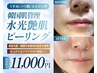 【くすみ/ハリ艶/エイジング】韓国肌管理★艶肌ピーリング￥11,000