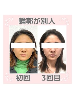 ビューティスタジオＫ/小顔フェイシャルで別人級の輪郭