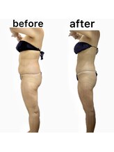 フローレンス(Florence)/30代産後の○○さんの変化