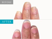 育爪 梅田店/爪を固めていないと不安でした